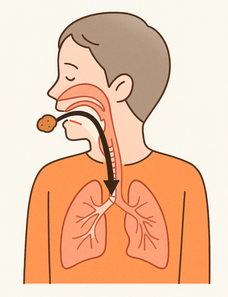 誤嚥性肺炎について